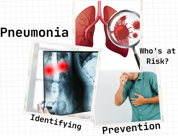 Pneumonia